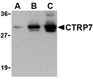 C1QTNF7 / CTRP7 Antibody - Western blot of recombinant CTRP7: (A) 5 ng, (B) 25 ng, and (C) 50 ng with anti-CTRP2 at 1 ug/ml.