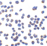 C1QTNF7 / CTRP7 Antibody - Immunocytochemistry of CTRP7 in 293 cells with CTRP7 antibody at 10 µg/ml.