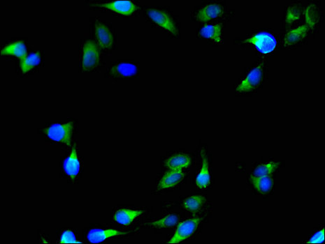 C1QTNF9B Antibody - Immunofluorescent analysis of Hela cells using C1QTNF9B Antibody at a dilution of 1:100 and Alexa Fluor 488-congugated AffiniPure Goat Anti-Rabbit IgG(H+L)