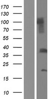C1QTNF9B Protein - Western validation with an anti-DDK antibody * L: Control HEK293 lysate R: Over-expression lysate