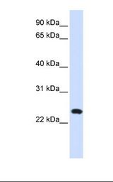 C20orf103 Antibody - 721_B cell lysate. Antibody concentration: 1.0 ug/ml. Gel concentration: 12%.  This image was taken for the unconjugated form of this product. Other forms have not been tested.