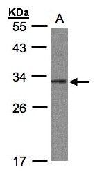 C20orf11 / TWA1 Antibody - Sample (30 ug whole cell lysate). A:293T. 12% SDS PAGE. C20orf11 / TWA1 antibody diluted at 1:1000