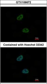 C20orf11 / TWA1 Antibody - Immunofluorescence of paraformaldehyde-fixed HeLa using C20orf11 antibody at 1:1000 dilution.