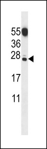 C20orf11 / TWA1 Antibody - CT011 Antibody western blot of mouse testis tissue lysates (35 ug/lane). The CT011 antibody detected the CT011 protein (arrow).