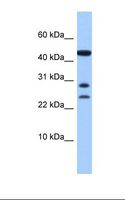 C20orf141 Antibody - Hela cell lysate. Antibody concentration: 1.0 ug/ml. Gel concentration: 10-20%.  This image was taken for the unconjugated form of this product. Other forms have not been tested.