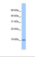C20orf141 Antibody - MCF7 cell lysate. Antibody concentration: 1.0 ug/ml. Gel concentration: 10%-20%.  This image was taken for the unconjugated form of this product. Other forms have not been tested.