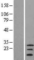 C20orf141 Protein - Western validation with an anti-DDK antibody * L: Control HEK293 lysate R: Over-expression lysate