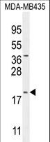 C20orf173 Antibody - CT173 Antibody western blot of MDA-MB435 cell line lysates (35 ug/lane). The CT173 antibody detected the CT173 protein (arrow).