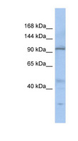 C20orf194 Antibody - C20orf194 antibody Western blot of SH-SYSY lysate. This image was taken for the unconjugated form of this product. Other forms have not been tested.