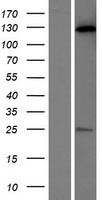 C20orf194 Protein - Western validation with an anti-DDK antibody * L: Control HEK293 lysate R: Over-expression lysate