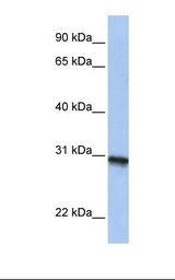 C20orf195 Antibody - MCF7 cell lysate. Antibody concentration: 1.0 ug/ml. Gel concentration: 12%.  This image was taken for the unconjugated form of this product. Other forms have not been tested.