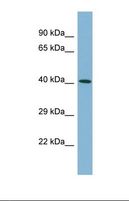 C20orf195 Antibody - Western blot of Human ACHN. C20orf195 antibody dilution 1.0 ug/ml.  This image was taken for the unconjugated form of this product. Other forms have not been tested.
