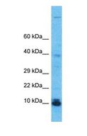 C20orf197 Antibody - Western blot of C20orf197 Antibody with human HeLa Whole Cell lysate.  This image was taken for the unconjugated form of this product. Other forms have not been tested.