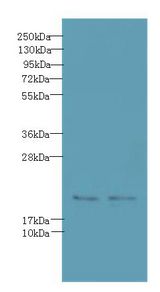 C20orf27 Antibody - Western blot. All lanes: C20orf27 antibody at 6 ug/ml. Lane 1: HCT116 whole cell lysate. Lane 2: MDA-MB-231 whole cell lysate. Secondary Goat polyclonal to Rabbit IgG at 1:10000 dilution. Predicted band size: 19 kDa. Observed band size: 19 kDa.