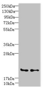C20orf27 Antibody - Western blot All lanes: C20orf27 antibody at 6µg/ml Lane 1: HCT116 whole cell lysate Lane 2: MDA-MB-231 whole cell lysate Secondary Goat polyclonal to rabbit IgG at 1/10000 dilution Predicted band size: 20, 22 kDa Observed band size: 20 kDa