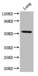 C20orf54 Antibody - Positive WB detected in:Mouse lung tissue;All lanes: Q9NQ4 antibody at 3.2ug/ml;Secondary;Goat polyclonal to rabbit IgG at 1/50000 dilution;Predicted band size: 51,46 kDa;Observed band size: 51 kDa;