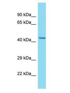 C20orf96 Antibody - C20orf96 antibody Western Blot of MCF7. Antibody dilution: 1 ug/ml.  This image was taken for the unconjugated form of this product. Other forms have not been tested.