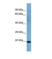 C21orf2 Antibody - Western blot of Human THP-1. C21orf2 antibody dilution 1.0 ug/ml.  This image was taken for the unconjugated form of this product. Other forms have not been tested.