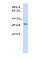 C21orf2 Antibody - C21orf2 antibody Western blot of 293T cell lysate. This image was taken for the unconjugated form of this product. Other forms have not been tested.