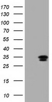 C21orf59 Antibody - HEK293T cells were transfected with the pCMV6-ENTRY control (Left lane) or pCMV6-ENTRY C21orf59 (Right lane) cDNA for 48 hrs and lysed. Equivalent amounts of cell lysates (5 ug per lane) were separated by SDS-PAGE and immunoblotted with anti-C21orf59.