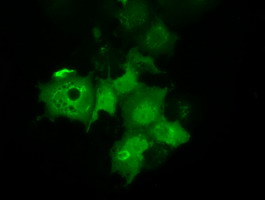 C21orf59 Antibody - Anti-C21orf59 mouse monoclonal antibody  immunofluorescent staining of COS7 cells transiently transfected by pCMV6-ENTRY C21orf59.