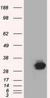 C21orf59 Antibody - HEK293T cells were transfected with the pCMV6-ENTRY control (Left lane) or pCMV6-ENTRY C21orf59 (Right lane) cDNA for 48 hrs and lysed. Equivalent amounts of cell lysates (5 ug per lane) were separated by SDS-PAGE and immunoblotted with anti-C21orf59.