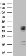 C21orf62 Antibody - HEK293T cells were transfected with the pCMV6-ENTRY control. (Left lane) or pCMV6-ENTRY C21orf62. (Right lane) cDNA for 48 hrs and lysed. Equivalent amounts of cell lysates. (5 ug per lane) were separated by SDS-PAGE and immunoblotted with anti-C21orf62. (1:2000)