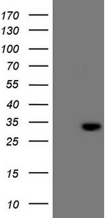 C21orf62 Antibody - HEK293T cells were transfected with the pCMV6-ENTRY control. (Left lane) or pCMV6-ENTRY C21orf62. (Right lane) cDNA for 48 hrs and lysed. Equivalent amounts of cell lysates. (5 ug per lane) were separated by SDS-PAGE and immunoblotted with anti-C21orf62. (1:2000)