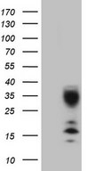 C21orf62 Antibody - HEK293T cells were transfected with the pCMV6-ENTRY control. (Left lane) or pCMV6-ENTRY C21orf62. (Right lane) cDNA for 48 hrs and lysed. Equivalent amounts of cell lysates. (5 ug per lane) were separated by SDS-PAGE and immunoblotted with anti-C21orf62. (1:2000)