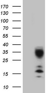 C21orf62 Antibody - HEK293T cells were transfected with the pCMV6-ENTRY control. (Left lane) or pCMV6-ENTRY C21orf62. (Right lane) cDNA for 48 hrs and lysed