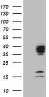 C21orf62 Antibody - HEK293T cells were transfected with the pCMV6-ENTRY control. (Left lane) or pCMV6-ENTRY C21orf62. (Right lane) cDNA for 48 hrs and lysed. Equivalent amounts of cell lysates. (5 ug per lane) were separated by SDS-PAGE and immunoblotted with anti-C21orf62. (1:500)