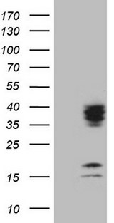 C21orf62 Antibody - HEK293T cells were transfected with the pCMV6-ENTRY control. (Left lane) or pCMV6-ENTRY C21orf62. (Right lane) cDNA for 48 hrs and lysed