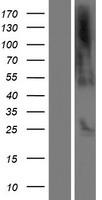 C21orf62 Protein - Western validation with an anti-DDK antibody * L: Control HEK293 lysate R: Over-expression lysate