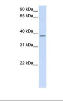C21orf91 Antibody - Fetal lung lysate. Antibody concentration: 1.0 ug/ml. Gel concentration: 12%.  This image was taken for the unconjugated form of this product. Other forms have not been tested.