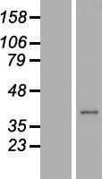 C21orf91 Protein - Western validation with an anti-DDK antibody * L: Control HEK293 lysate R: Over-expression lysate