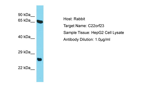 C22orf23 Antibody -  This image was taken for the unconjugated form of this product. Other forms have not been tested.