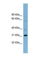 C22orf31 Antibody - C22orf31 antibody Western blot of Fetal Spleen lysate. This image was taken for the unconjugated form of this product. Other forms have not been tested.