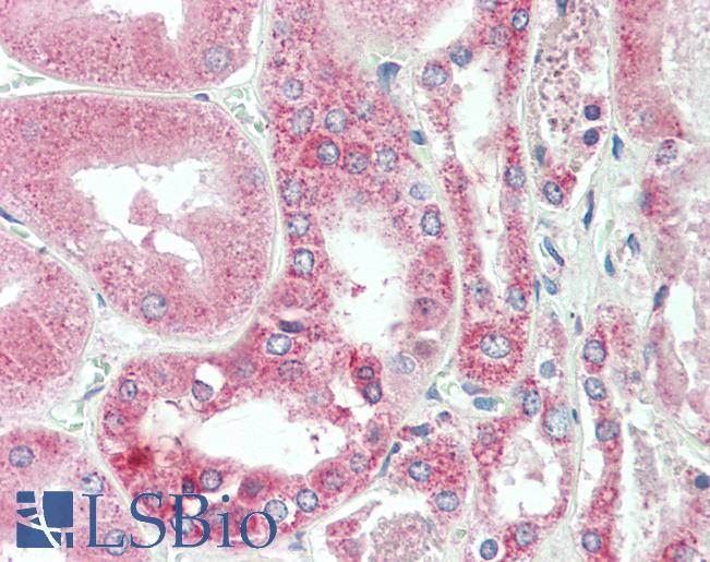 C25H / CH25H Antibody - Anti-C25H / CH25H antibody IHC staining of human kidney. Immunohistochemistry of formalin-fixed, paraffin-embedded tissue after heat-induced antigen retrieval. Antibody concentration 10 ug/ml.  This image was taken for the unconjugated form of this product. Other forms have not been tested.