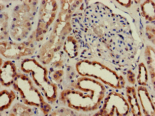 C25H / CH25H Antibody - Immunohistochemistry of paraffin-embedded human kidney tissue at dilution of 1:100