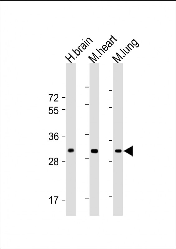 C25H / CH25H Antibody - All lanes: Anti-CH25H Antibody (N-Term) at 1:1000-1:2000 dilution Lane 1: Human brain lysate Lane 2: Mouse heart lysate Lane 3: Mouse lung lysate Lysates/proteins at 20 µg per lane. Secondary Goat Anti-Rabbit IgG, (H+L), Peroxidase conjugated at 1/10000 dilution. Predicted band size: 32 kDa Blocking/Dilution buffer: 5% NFDM/TBST.