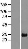 C25H / CH25H Protein - Western validation with an anti-DDK antibody * L: Control HEK293 lysate R: Over-expression lysate