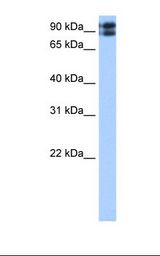 C2CD2L / TMEM24 Antibody - Transfected 293T cell lysate. Antibody concentration: 0.5 ug/ml. Gel concentration: 12%.  This image was taken for the unconjugated form of this product. Other forms have not been tested.