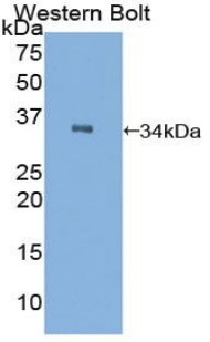 C2CD3 Antibody - Western blot of recombinant C2CD3.  This image was taken for the unconjugated form of this product. Other forms have not been tested.