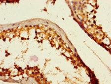 C2CD3 Antibody - Immunohistochemistry of paraffin-embedded human testicular tissue using C2CD3 Antibody at dilution of 1:100