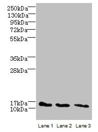 C2orf15 Antibody - Western blot All lanes: C2orf15 antibody at 6µg/ml Lane 1: U251 whole cell lysate Lane 2: MCF-7 whole cell lysate Lane 3: HCT116 whole cell lysate Secondary Goat polyclonal to rabbit IgG at 1/10000 dilution Predicted band size: 14 kDa Observed band size: 14 kDa