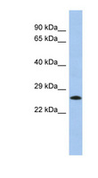 C2orf27A / C2orf27 Antibody - C2orf27B antibody Western blot of Fetal Lung lysate. This image was taken for the unconjugated form of this product. Other forms have not been tested.
