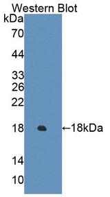 C2orf40 / ECRG4 Antibody - Western blot of C2orf40 / ECRG4 antibody.