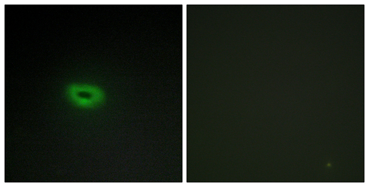 C2orf40 / ECRG4 Antibody - Immunofluorescence analysis of A549 cells, using ECRG4 Antibody. The picture on the right is blocked with the synthesized peptide.