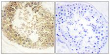 C2orf40 / ECRG4 Antibody - Immunohistochemistry analysis of paraffin-embedded human testis tissue, using ECRG4 Antibody. The picture on the right is blocked with the synthesized peptide.