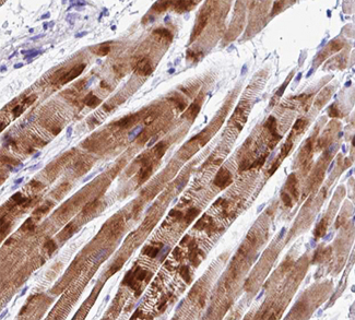 C2orf40 / ECRG4 Antibody - 1:100 staining human skeletal muscle tissue by IHC-P. The tissue was formaldehyde fixed and a heat mediated antigen retrieval step in citrate buffer was performed. The tissue was then blocked and incubated with the antibody for 1.5 hours at 22°C. An HRP conjugated goat anti-rabbit antibody was used as the secondary.
